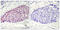 Activating Transcription Factor 2 antibody, LS-C118049, Lifespan Biosciences, Immunohistochemistry paraffin image 