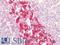 Tubulin Beta 3 Class III antibody, LS-A12513, Lifespan Biosciences, Immunohistochemistry paraffin image 
