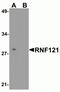 Ring Finger Protein 121 antibody, NBP2-81947, Novus Biologicals, Western Blot image 