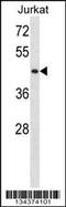 Serine/Threonine Kinase 33 antibody, 58-117, ProSci, Western Blot image 
