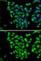 ADP Ribosylation Factor GTPase Activating Protein 1 antibody, GTX55515, GeneTex, Immunocytochemistry image 
