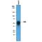 Tissue Factor Pathway Inhibitor antibody, AF2974, R&D Systems, Western Blot image 