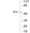 SH2 Domain Containing Adaptor Protein B antibody, LS-C200003, Lifespan Biosciences, Western Blot image 