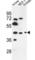 Pregnancy Specific Beta-1-Glycoprotein 3 antibody, abx034422, Abbexa, Western Blot image 