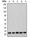 Anti-Silencing Function 1A Histone Chaperone antibody, orb382526, Biorbyt, Western Blot image 