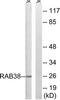 RAB38, Member RAS Oncogene Family antibody, TA315269, Origene, Western Blot image 
