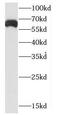 Cyclin Dependent Kinase 19 antibody, FNab01526, FineTest, Western Blot image 