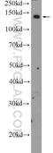 Adenylate Cyclase 8 antibody, 55065-1-AP, Proteintech Group, Western Blot image 