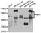 NBR1 Autophagy Cargo Receptor antibody, STJ24692, St John