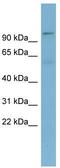 Transducin Beta Like 3 antibody, TA340113, Origene, Western Blot image 