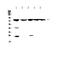 G Protein-Coupled Receptor Kinase 2 antibody, PA5-79330, Invitrogen Antibodies, Western Blot image 