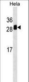 Transmembrane P24 Trafficking Protein 1 antibody, LS-C157208, Lifespan Biosciences, Western Blot image 