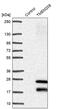 Transmembrane Protein 208 antibody, PA5-59800, Invitrogen Antibodies, Western Blot image 