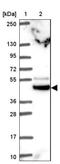 Tripartite Motif Containing 44 antibody, NBP2-31681, Novus Biologicals, Western Blot image 