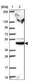 Tripartite motif-containing protein 44 antibody, NBP2-31681, Novus Biologicals, Western Blot image 