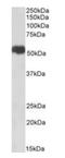Solute Carrier Family 40 Member 1 antibody, orb233663, Biorbyt, Western Blot image 