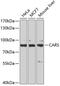 Cysteinyl-TRNA Synthetase antibody, GTX32489, GeneTex, Western Blot image 