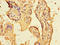 Fibroblast Growth Factor 13 antibody, LS-C375712, Lifespan Biosciences, Immunohistochemistry paraffin image 