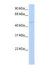 TGFB Induced Factor Homeobox 1 antibody, NBP1-54349, Novus Biologicals, Western Blot image 