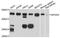 Eukaryotic Translation Initiation Factor 4A3 antibody, A4338, ABclonal Technology, Western Blot image 