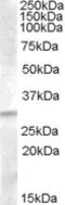 Insulin Like Growth Factor Binding Protein 4 antibody, LS-C54999, Lifespan Biosciences, Western Blot image 