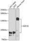 Lysine Methyltransferase 2E antibody, A08526, Boster Biological Technology, Western Blot image 