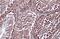 RAD51 Recombinase antibody, GTX100469, GeneTex, Immunohistochemistry paraffin image 