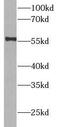 Cytochrome P450 Family 3 Subfamily A Member 4 antibody, FNab02165, FineTest, Western Blot image 