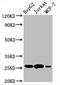 BCL2 antibody, CSB-RA002611A0HU, Cusabio, Western Blot image 