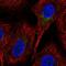 Solute Carrier Family 2 Member 2 antibody, NBP2-49410, Novus Biologicals, Immunocytochemistry image 