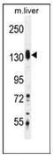 SAM And SH3 Domain Containing 1 antibody, AP53800PU-N, Origene, Western Blot image 