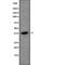 Ubiquitin Specific Peptidase 50 antibody, abx219288, Abbexa, Western Blot image 