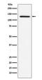 Interferon Induced With Helicase C Domain 1 antibody, M00263-1, Boster Biological Technology, Western Blot image 