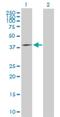 Mitochondrial Ribosomal Protein S31 antibody, H00010240-B01P, Novus Biologicals, Western Blot image 