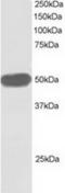 COP9 Signalosome Subunit 2 antibody, TA302410, Origene, Western Blot image 