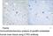 Citron Rho-Interacting Serine/Threonine Kinase antibody, MBS000713, MyBioSource, Immunohistochemistry paraffin image 