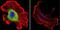 Cellular Retinoic Acid Binding Protein 1 antibody, NB300-539, Novus Biologicals, Immunocytochemistry image 