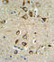 Acetylserotonin O-Methyltransferase antibody, LS-C156543, Lifespan Biosciences, Immunohistochemistry frozen image 
