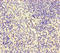 CD49D antibody, LS-C678385, Lifespan Biosciences, Immunohistochemistry paraffin image 