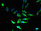 Proteolipid Protein 1 antibody, CSB-PA018202LA01HU, Cusabio, Immunofluorescence image 