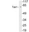 Mitogen-Activated Protein Kinase Kinase Kinase 7 antibody, LS-C200018, Lifespan Biosciences, Western Blot image 