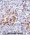 CUGBP Elav-Like Family Member 1 antibody, abx027755, Abbexa, Immunohistochemistry paraffin image 