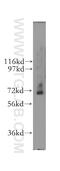 RNA Guanylyltransferase And 5'-Phosphatase antibody, 12430-1-AP, Proteintech Group, Western Blot image 