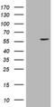 Cytochrome P450 Family 17 Subfamily A Member 1 antibody, NBP2-46418, Novus Biologicals, Western Blot image 