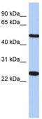 Transmembrane Protein 161B antibody, TA337837, Origene, Western Blot image 