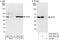 Eukaryotic Translation Initiation Factor 3 Subunit E antibody, A302-984A, Bethyl Labs, Western Blot image 