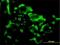 Eukaryotic Translation Initiation Factor 4E Family Member 2 antibody, H00009470-M01, Novus Biologicals, Immunocytochemistry image 