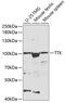 TTK Protein Kinase antibody, 18-671, ProSci, Western Blot image 