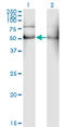 Aldehyde Dehydrogenase 2 Family Member antibody, LS-C196639, Lifespan Biosciences, Western Blot image 
