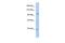 NEDD4 Like E3 Ubiquitin Protein Ligase antibody, PA5-42310, Invitrogen Antibodies, Western Blot image 